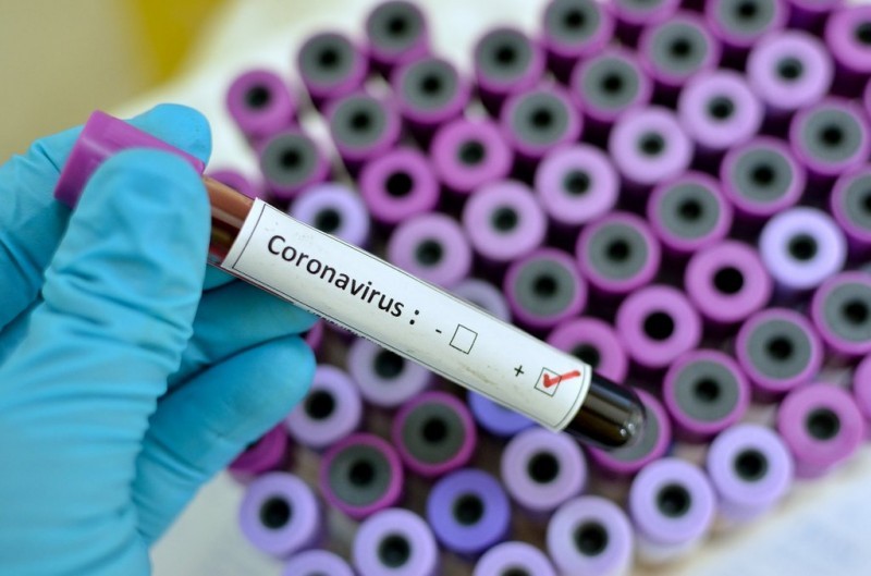 <span style='color:#780948'>ARCHIVED</span> - 596 confirmed coronavirus cases in Murcia as the death toll reaches 8